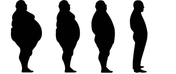 1. Obesidad y alteraciones metabólicas